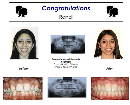 Before and After Case