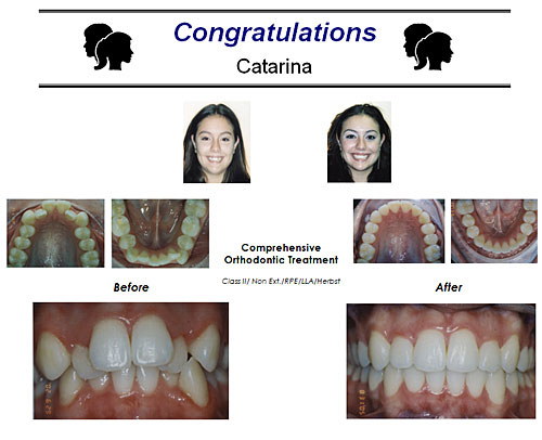 Before and After Case