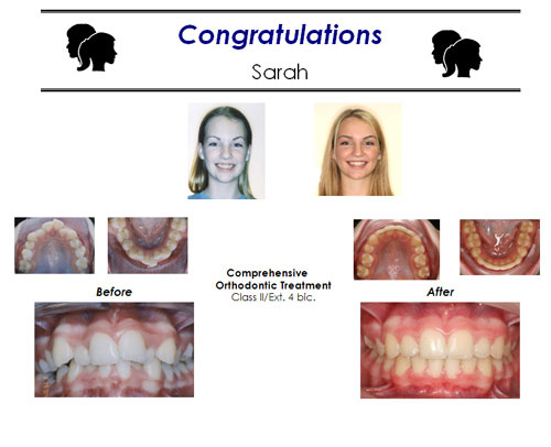 Before and After Case